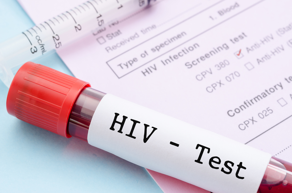 hogyan lehet a HIV-t továbbítani