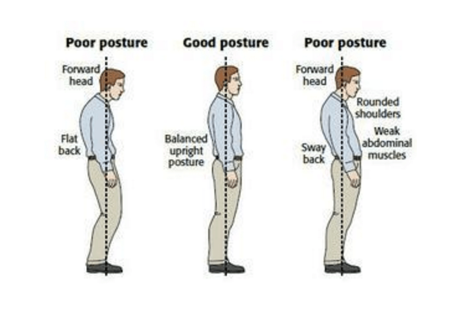 Képforrás: http://www.thephysiocompany.com/blog/stop-slouching-postural-dysfunction-symptoms-causes-and-treatment-of-bad-posture