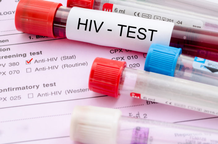 HIV-teszt