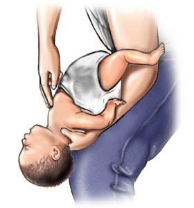 Lépések a csecsemők fulladásának (4-5) forrása: www.webmd.com