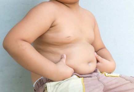 elhízás a gyermekeknél