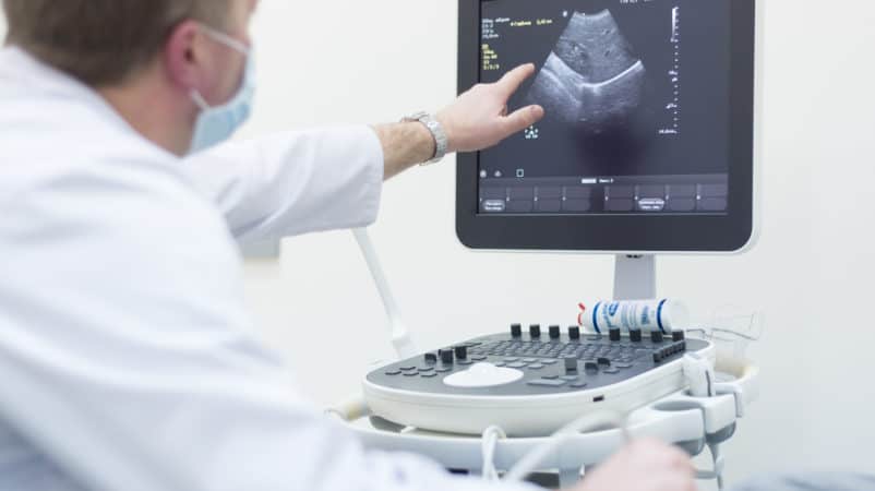 transzvaginális ultrahangvizsgálat