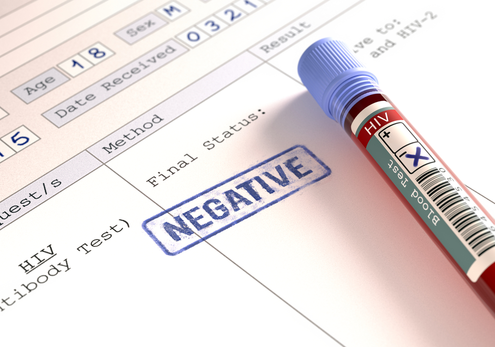 negatív HIV-teszt eredményeinek jelentése