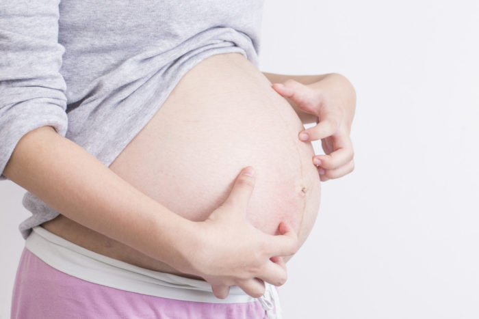 A terhesség alatt a viszkető bőrgyulladás oka a gyomorszívó folliculitis