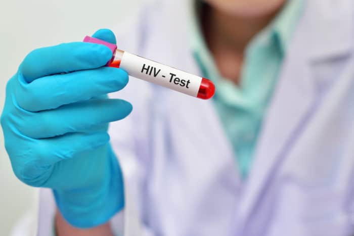 HIV vérvizsgálat